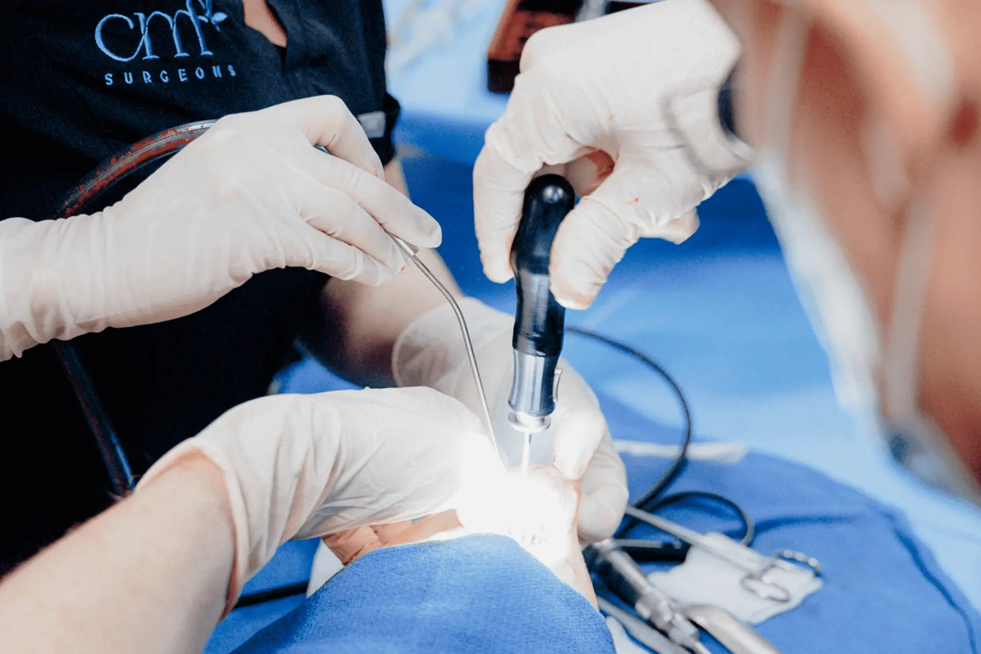 CMF surgeons operating with high-precision tools during a surgical case.
